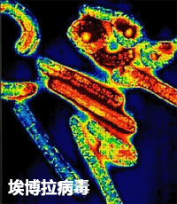 EBOV(埃博拉)病毒防护方案